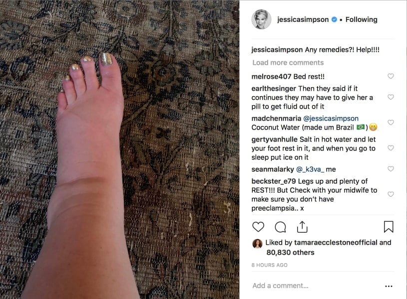 Jessica Simpson Shares Her Painful Pregnancy Swelling With Fans Kicks Count